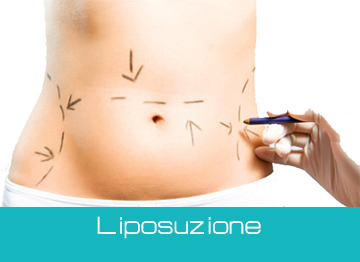 liposuzione-milano.jpg