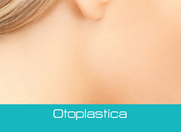 Otoplastica Milano