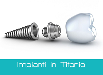 Impianti Dentali in Titanio Implantologia Avanzata